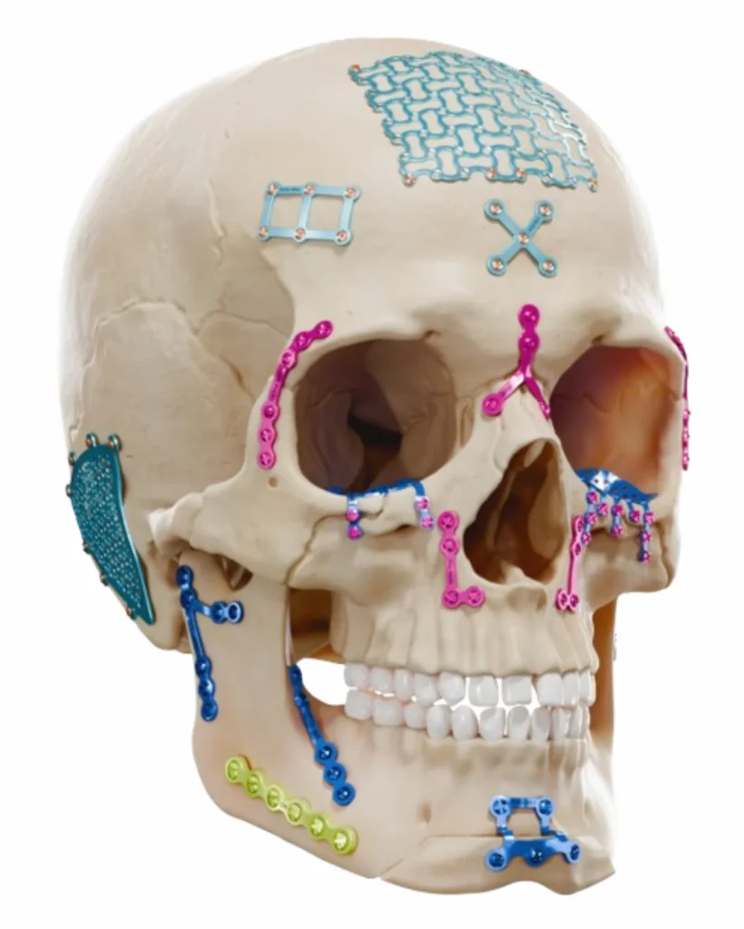 maxillofacial imaplnts-hp